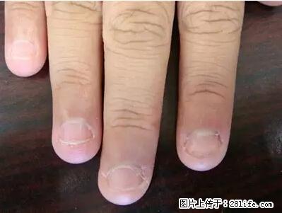 剪指甲、挖耳屎，这些日常小动作竟隐藏大危害！ - 辽阳生活资讯 - 辽阳28生活网 liaoyang.28life.net